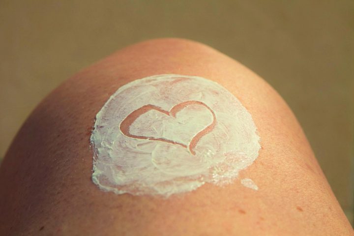 How to check your moles at home